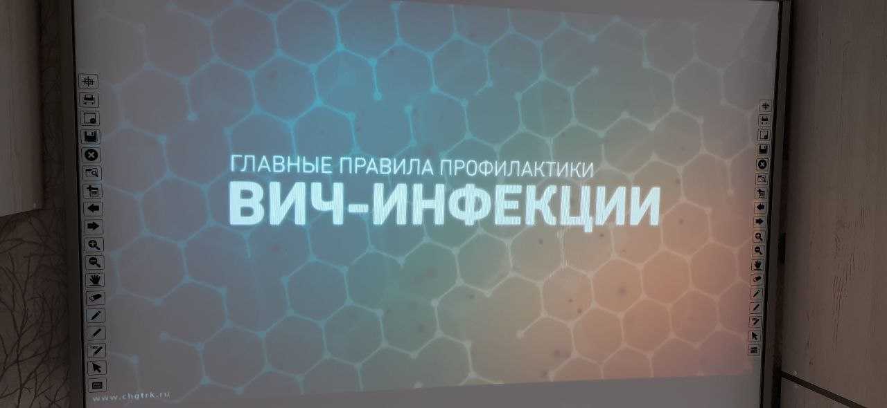 Противодействие распространению ВИЧ-инфекции.